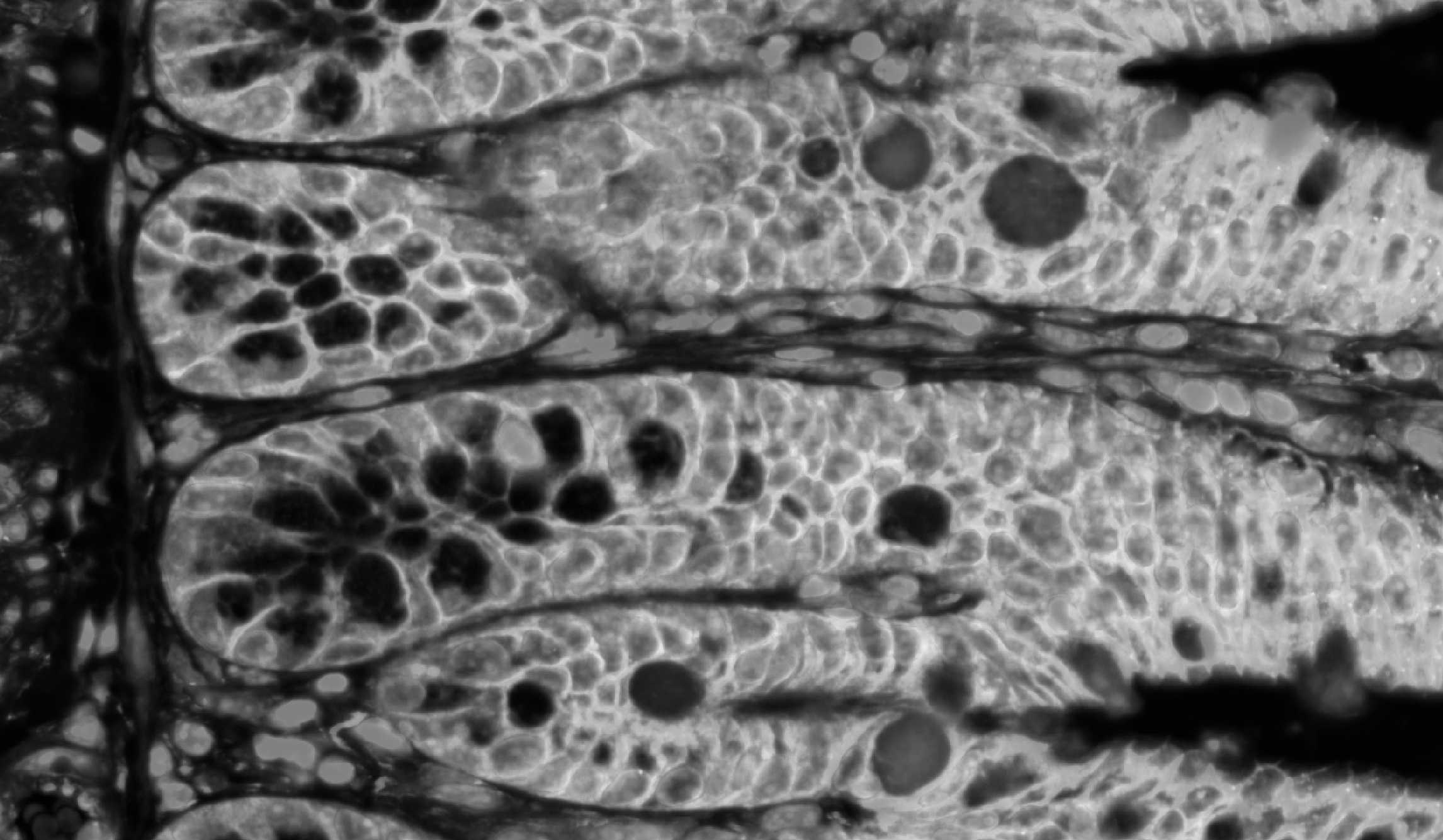 Fluorescence image of a villus