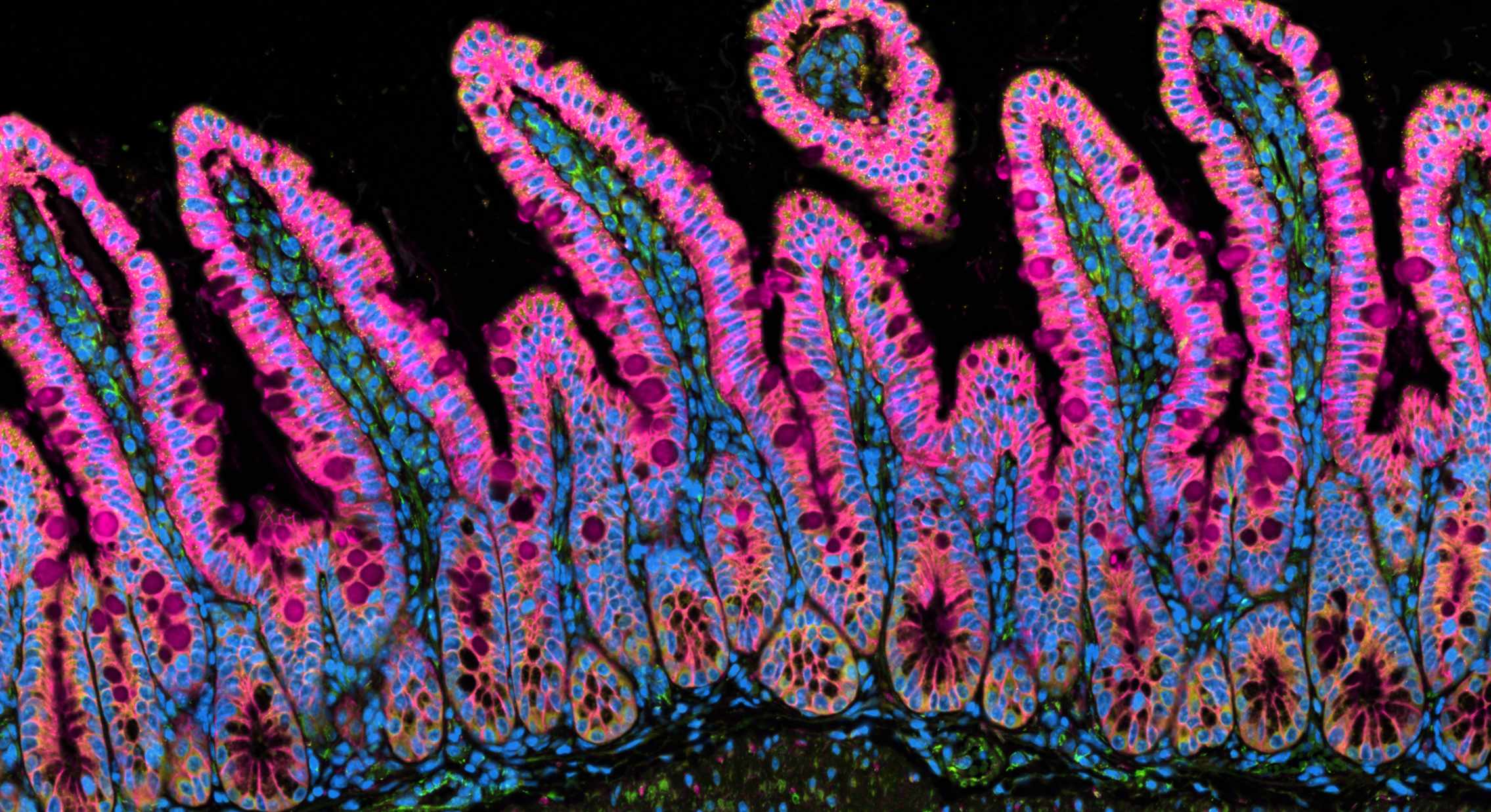 Xenium image showing the cell outlines